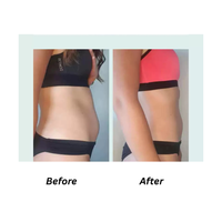 D-lab Flat Stomach Abdominal Fat & Bloating 1-Month