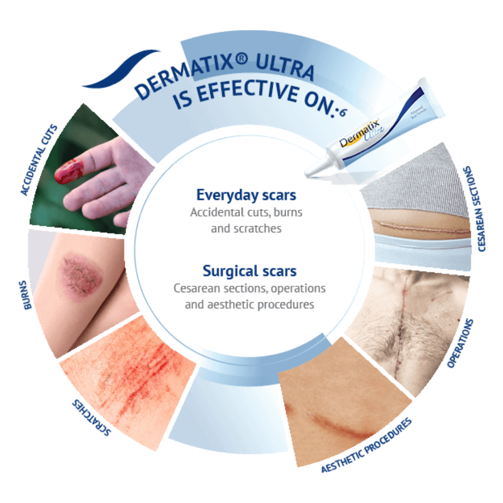 Dermatix Ultra Advanced Scar Formula 7g / 30g