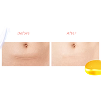 Dermatix Ultra Advanced Scar Formula 7g / 30g