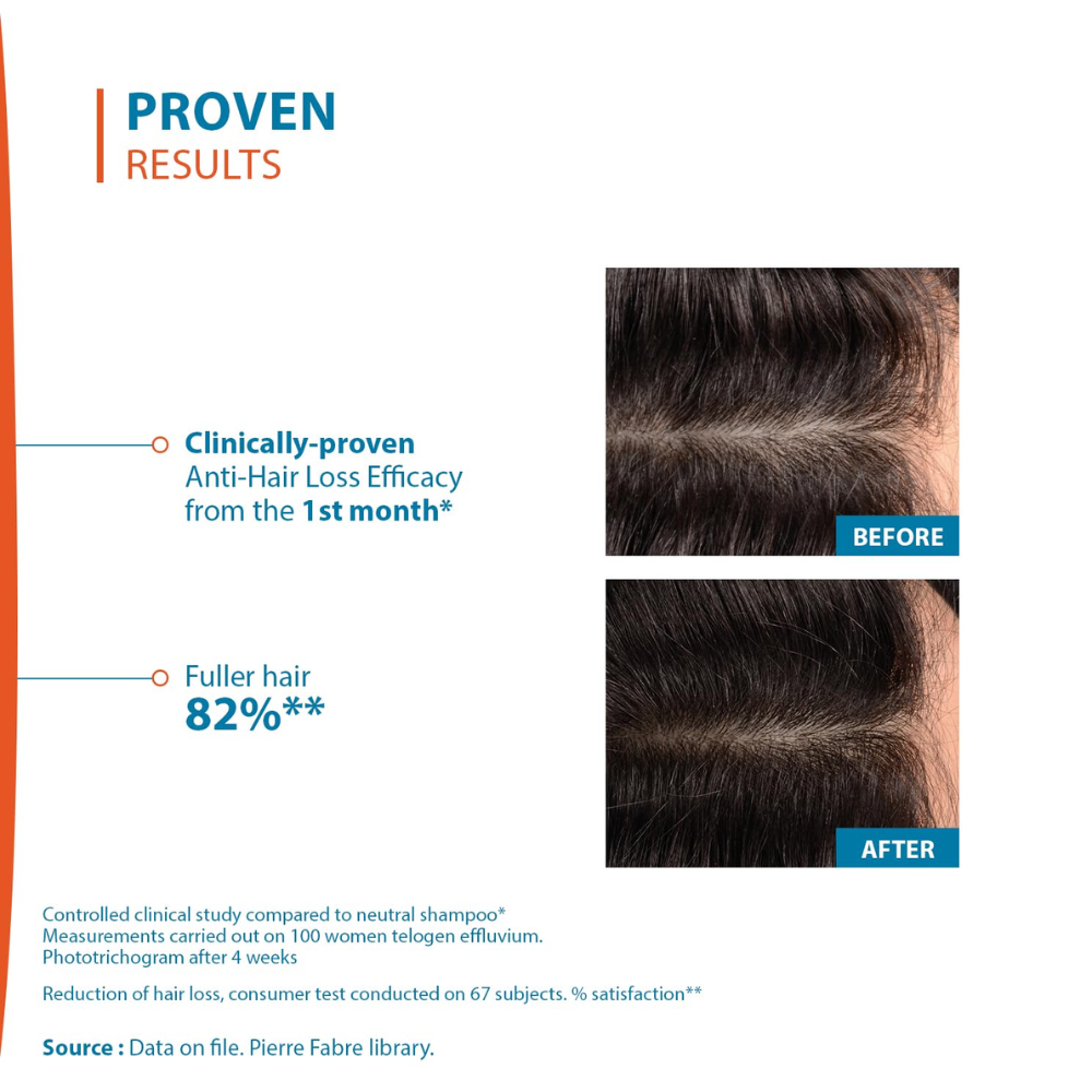Ducray Creastim Reactiv Anti-Hair Loss Lotion 60ml