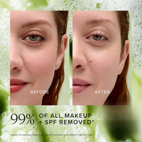 Farmacy Green Clean Makeup Meltaway Cleansing Balm 200ml