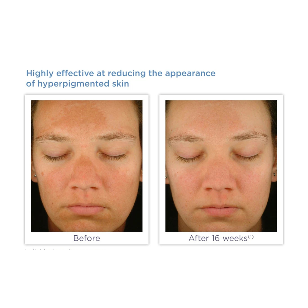 Glytone Enhance Brightening Complex Serum 30ml