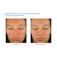 Glytone Enhance Brightening Complex Serum 30ml