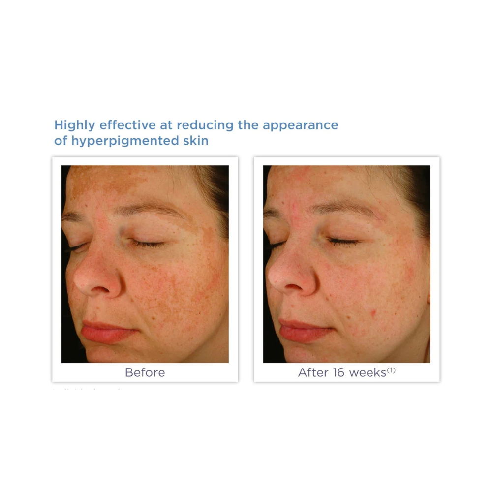 Glytone Enhance Brightening Complex Serum 30ml