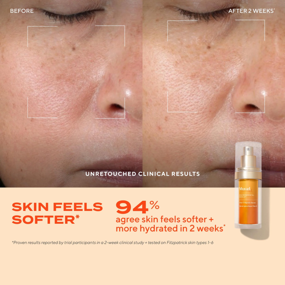 Murad Vita-C Glycolic Serum 30ml