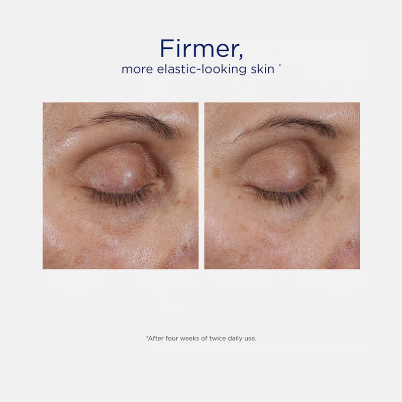 NeoStrata Intensive Eye Therapy With MicroDiPeptide229 15g