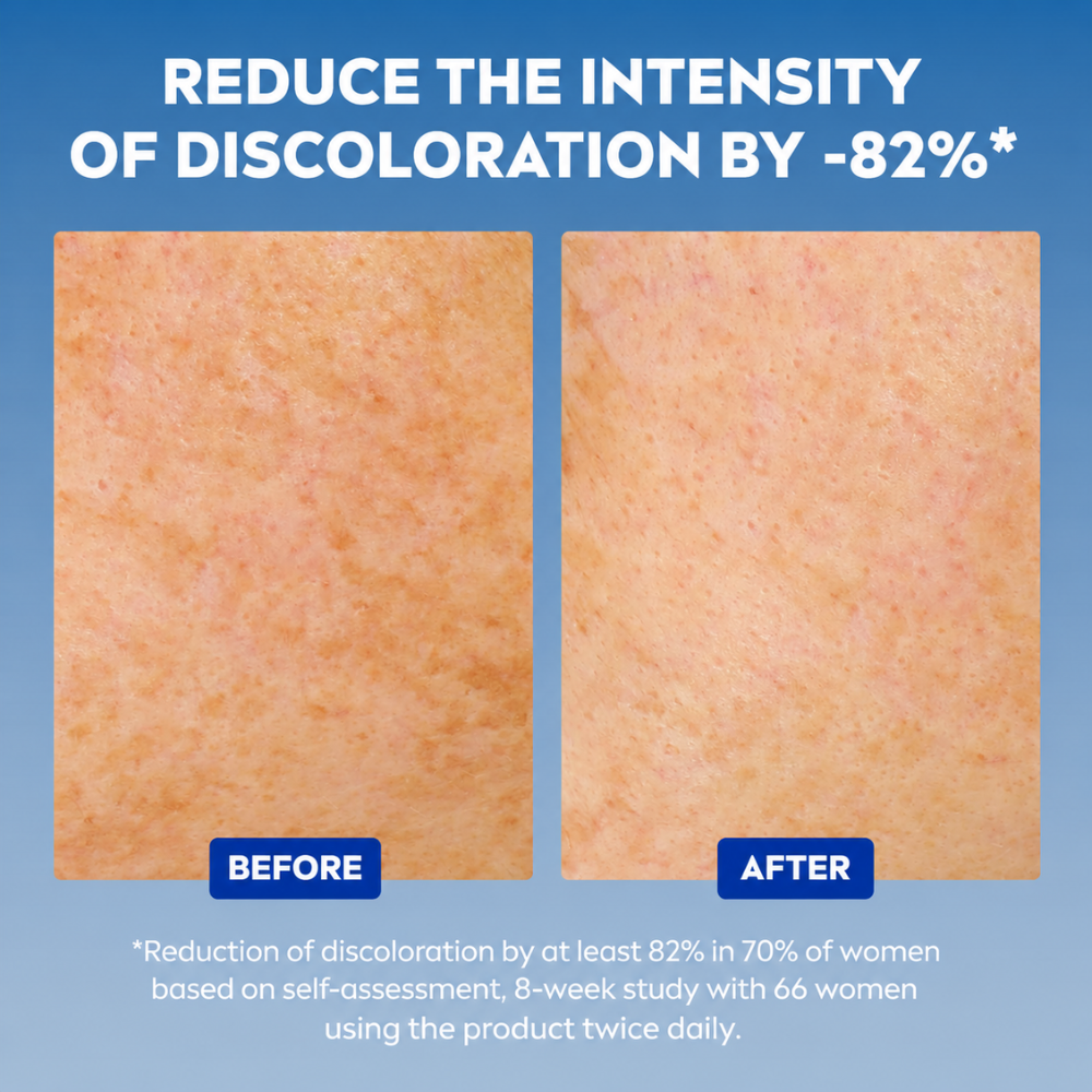 Nivea Luminous 630 Advanced Dark Spot Serum 30ml