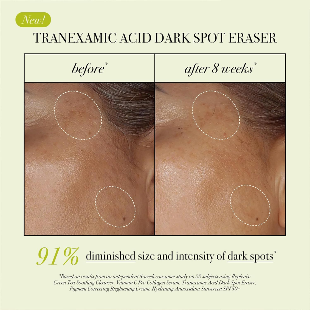 Replenix Tranexamic Acid Dark Spot Corrector 15ml