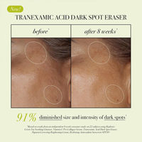 Replenix Tranexamic Acid Dark Spot Corrector 15ml