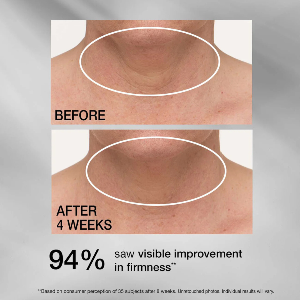 StriVectin TL Advanced Tightening Neck Cream Plus 50ml