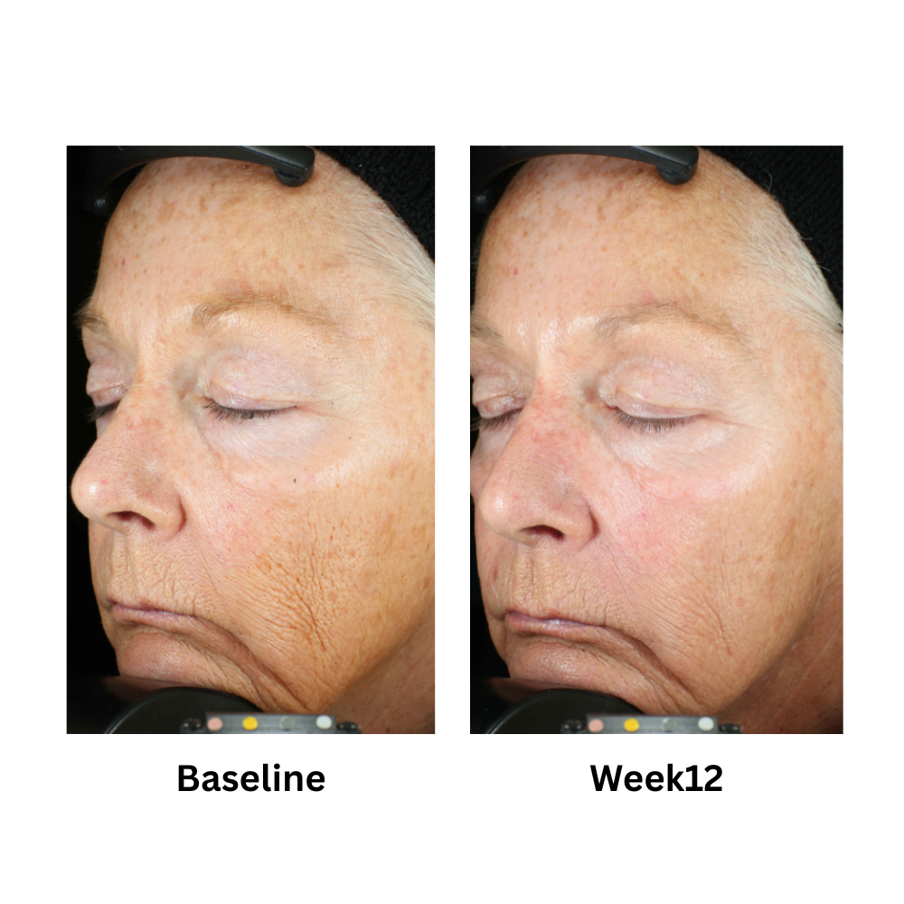 Zo Skin Health Wrinkle + Texture Repair 50ml