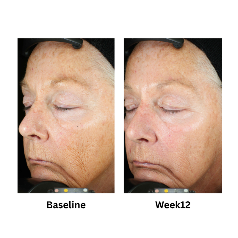 Zo Skin Health Wrinkle + Texture Repair 50ml