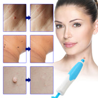 2-in-1 Auto Skin Tag Remover Kit