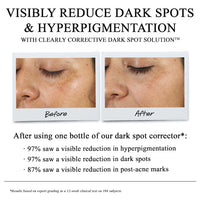 Kiehl's Clearly Corrective Dark Spot Solution 50ml