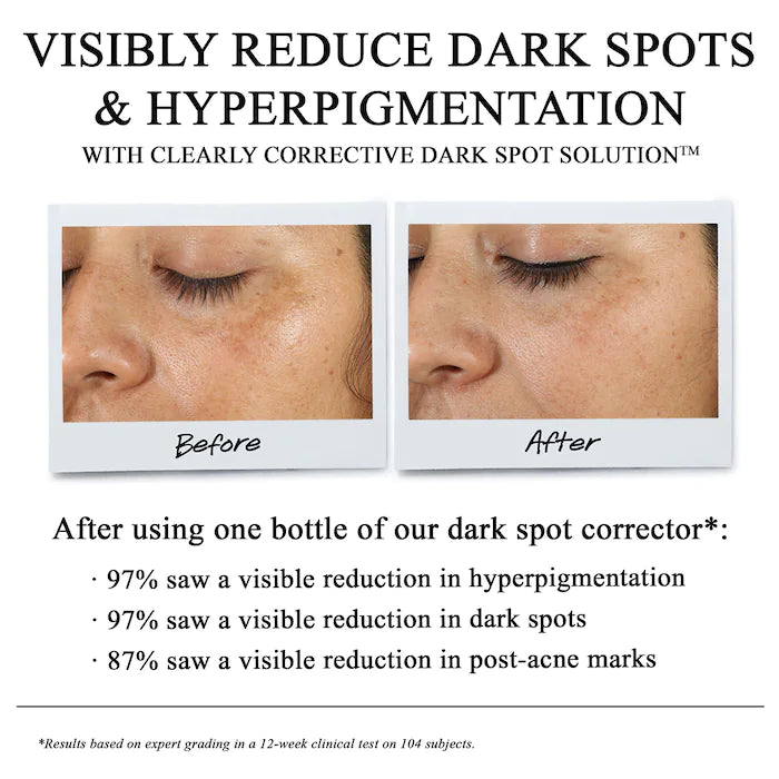 Kiehl's Clearly Corrective Dark Spot Solution 50ml