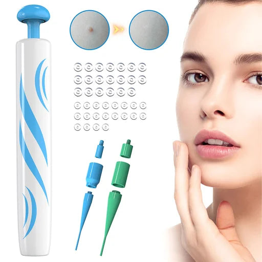 2 IN 1 Skin Tag Remover Device Kit For Medium To Large Skin Tags