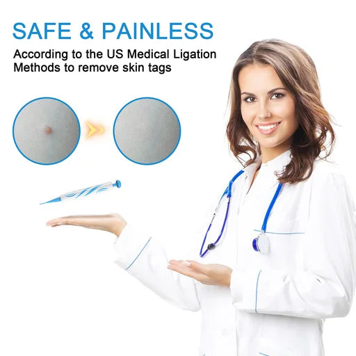2 IN 1 Skin Tag Remover Device Kit For Medium To Large Skin Tags